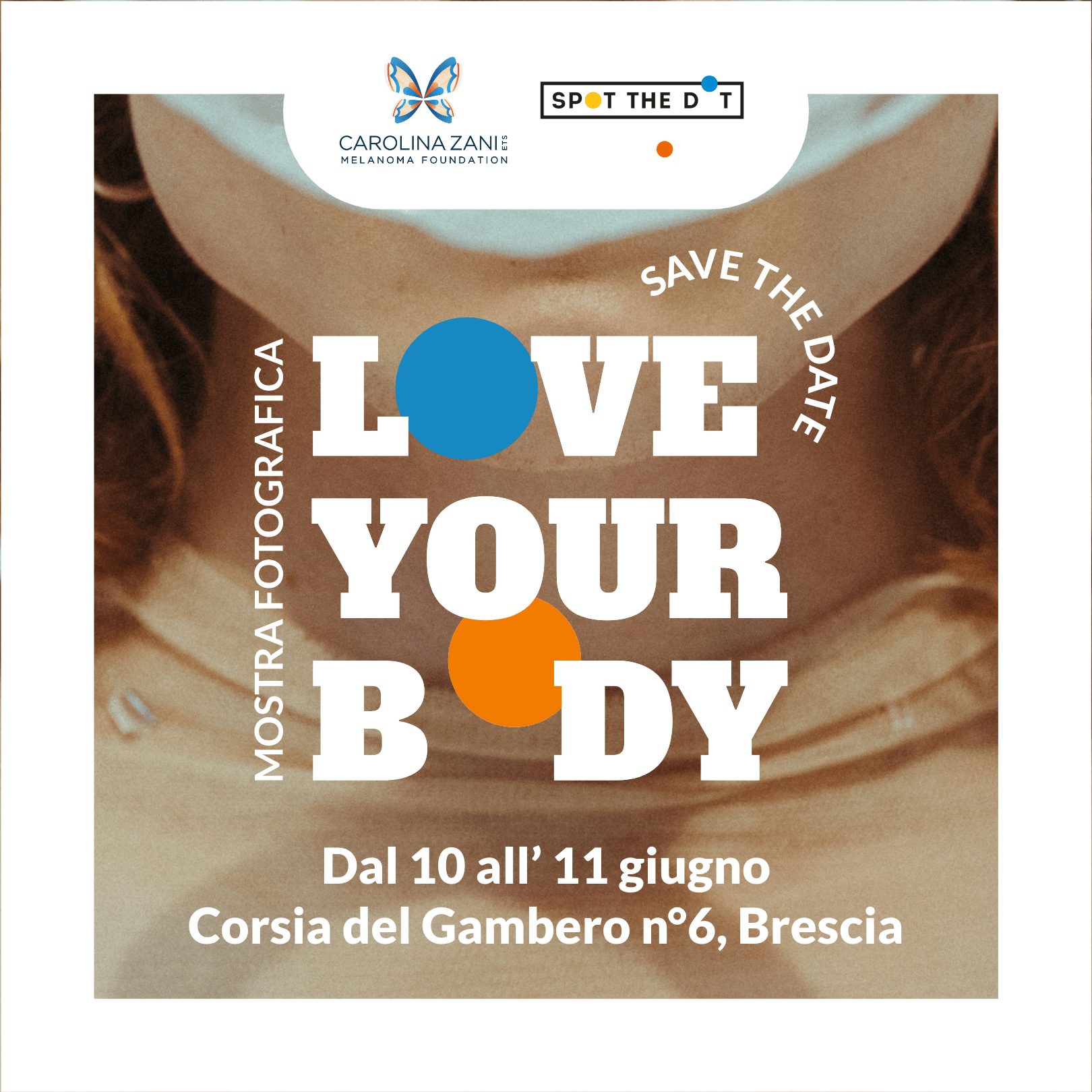 Love Your Body: Uniamo le forze contro il tumore della pelle 1